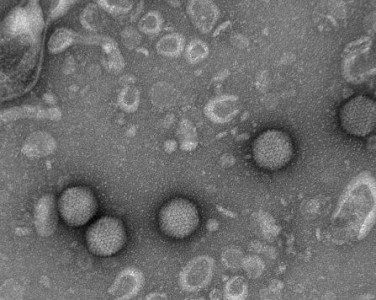 काठमाडौँको ढलमा देखियो पोलियो जीवाणु